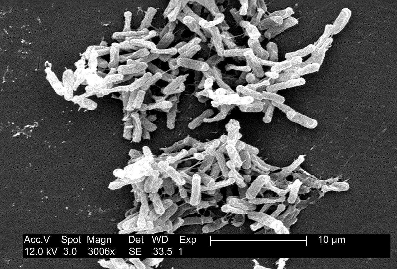 Scanning electron micrograph of Clostridioides difficile bacteria from a stool sample