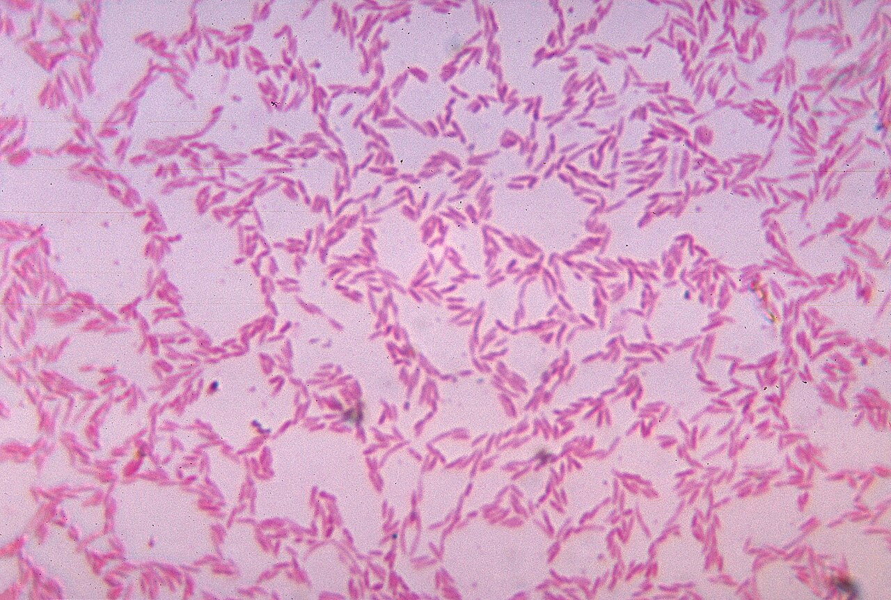 Bacteroides colonies cultured on blood agar for 48 hours under anaerobic conditions