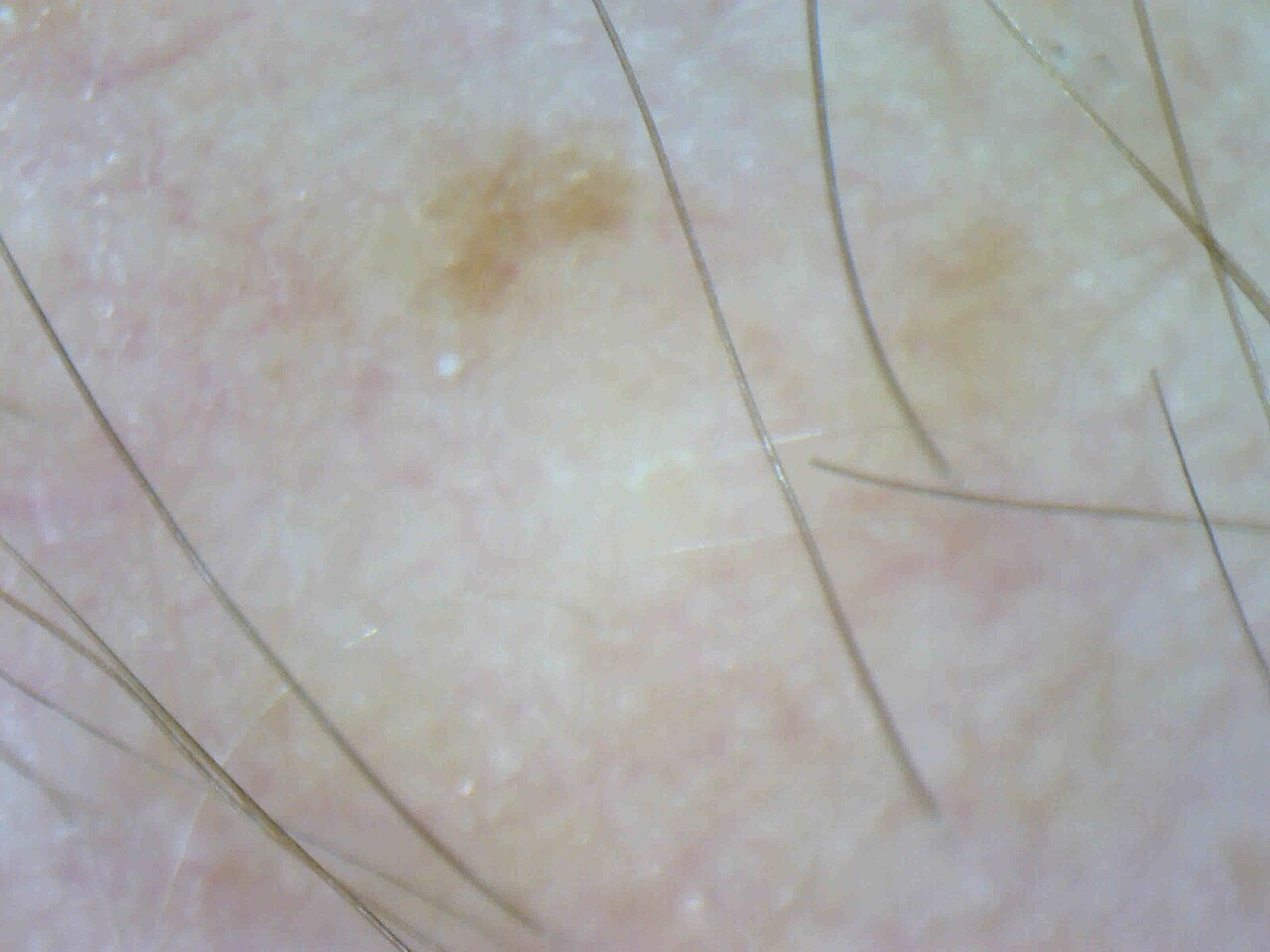 Human skin magnified two hundred times, showing cell layers in section